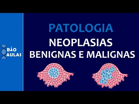 Benign and Malignant Neoplasms - Characteristics, Nomenclature and Differentiation (General Patho...