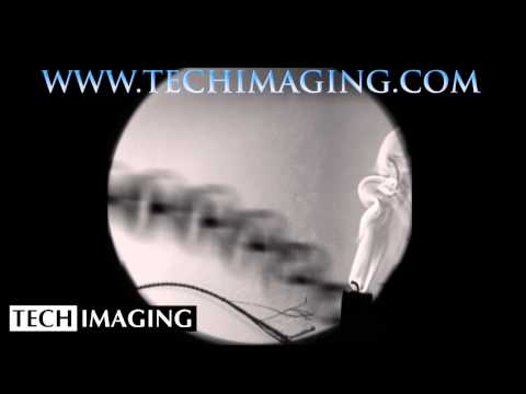 High Speed Camera Video - Whip cracking in schlieren