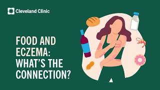 Food and Eczema: What’s the Connection?