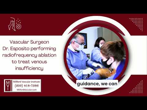 What is Radiofrequency Ablation? Watch Dr. Esposito Treat Venous Insufficiency with RF Ablation