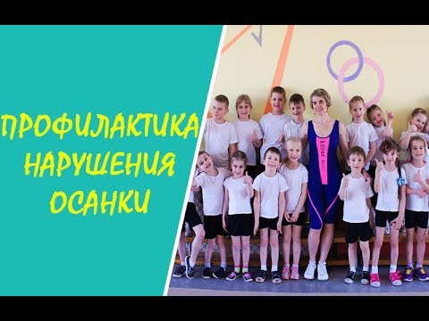 Сколиоз идиопатический 3-4 степени симптомы Лечебная физкультура при грудном кифозе