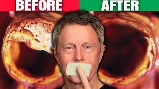 #1 BEST Meal to Clean Out Your Arteries