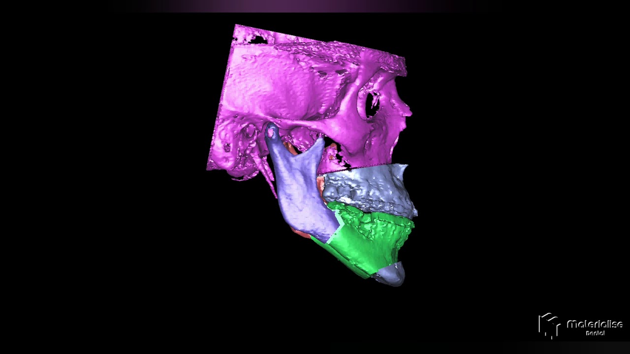 Marcos Adriano Da Silveira-6