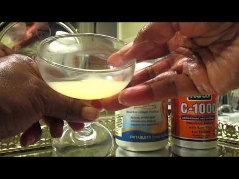 download lagu mp3 mp4 Verisol Bioactive Collagen Peptides, download lagu Verisol Bioactive Collagen Peptides gratis, unduh video klip Verisol Bioactive Collagen Peptides