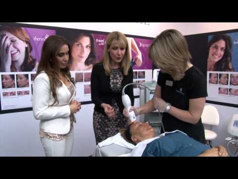 'Thermage' treatment demo at The Anti-Ageing Show