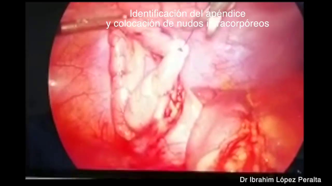 Ibrahim López Peralta-11