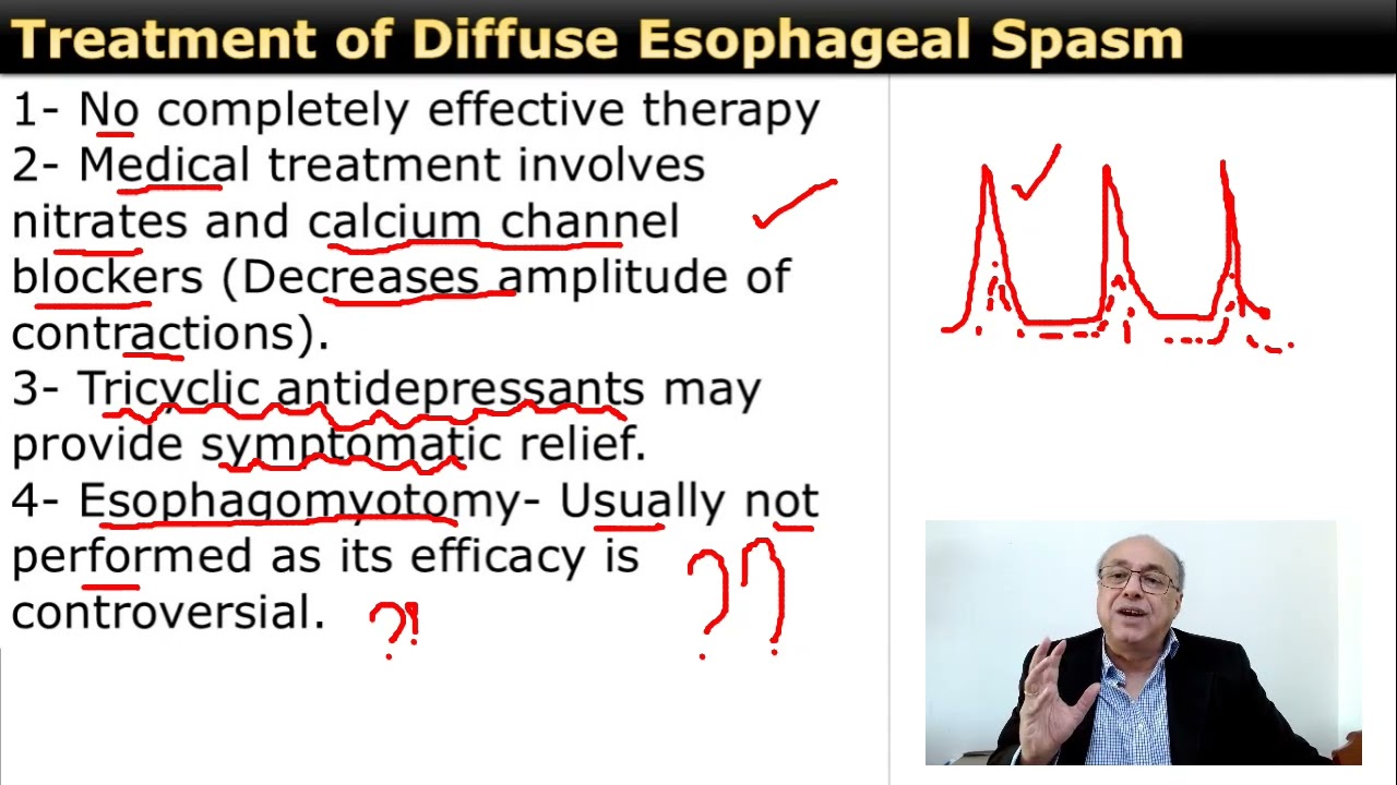 Diffuse Esophageal Spasm