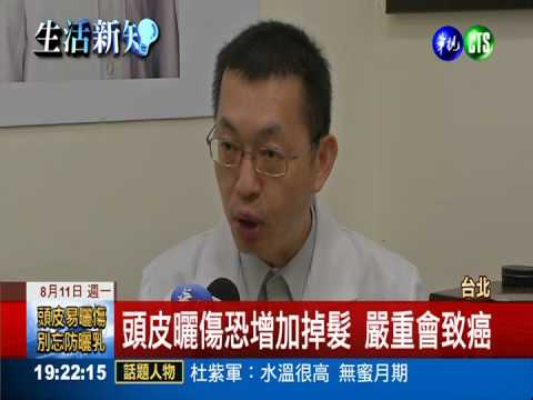 雄性禿戲水沒防曬 被太陽剝頭皮!