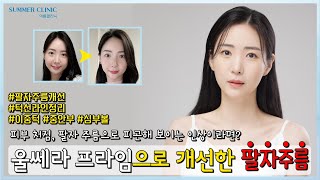 피부처짐과 팔자 주름으로 피곤해 보이는 인상이신분들 주목!! !! | 울쎄라 프라임 시술 브이로그