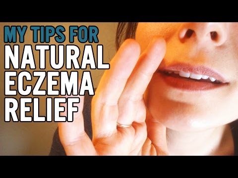 Natural Eczema Relief Video