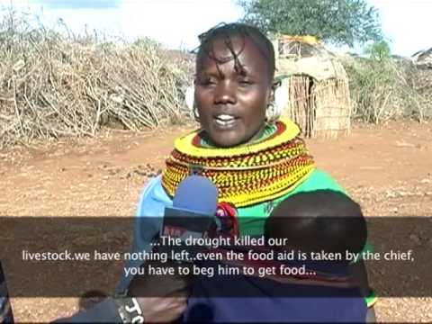 Baragoi Children suffer Kwashiorkor and Marasmus