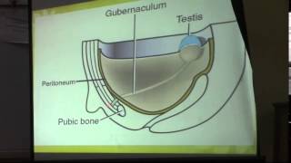 14)Dr.Doaa 27 /4 /2015 [development of testis&ovary]
