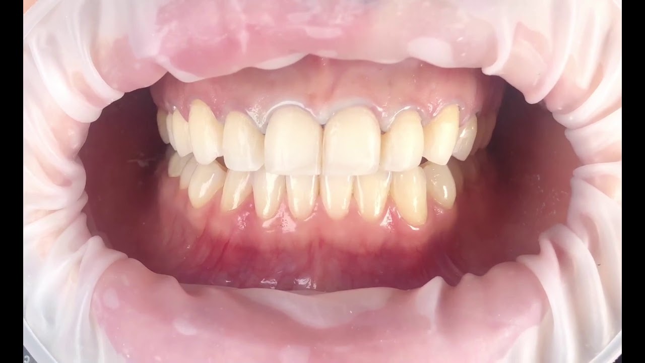 José Francisco Del Real García-113