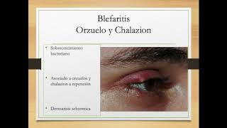 Urgencias oftalmológicas   Dra Fernandez Dr Diaz   Agosto 2020