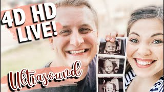 4D HD ULTRASOUND | 28 Weeks Pregnant 4D/5D HD Live Ultrasound | Rainbow Baby | The Carnahan Fam