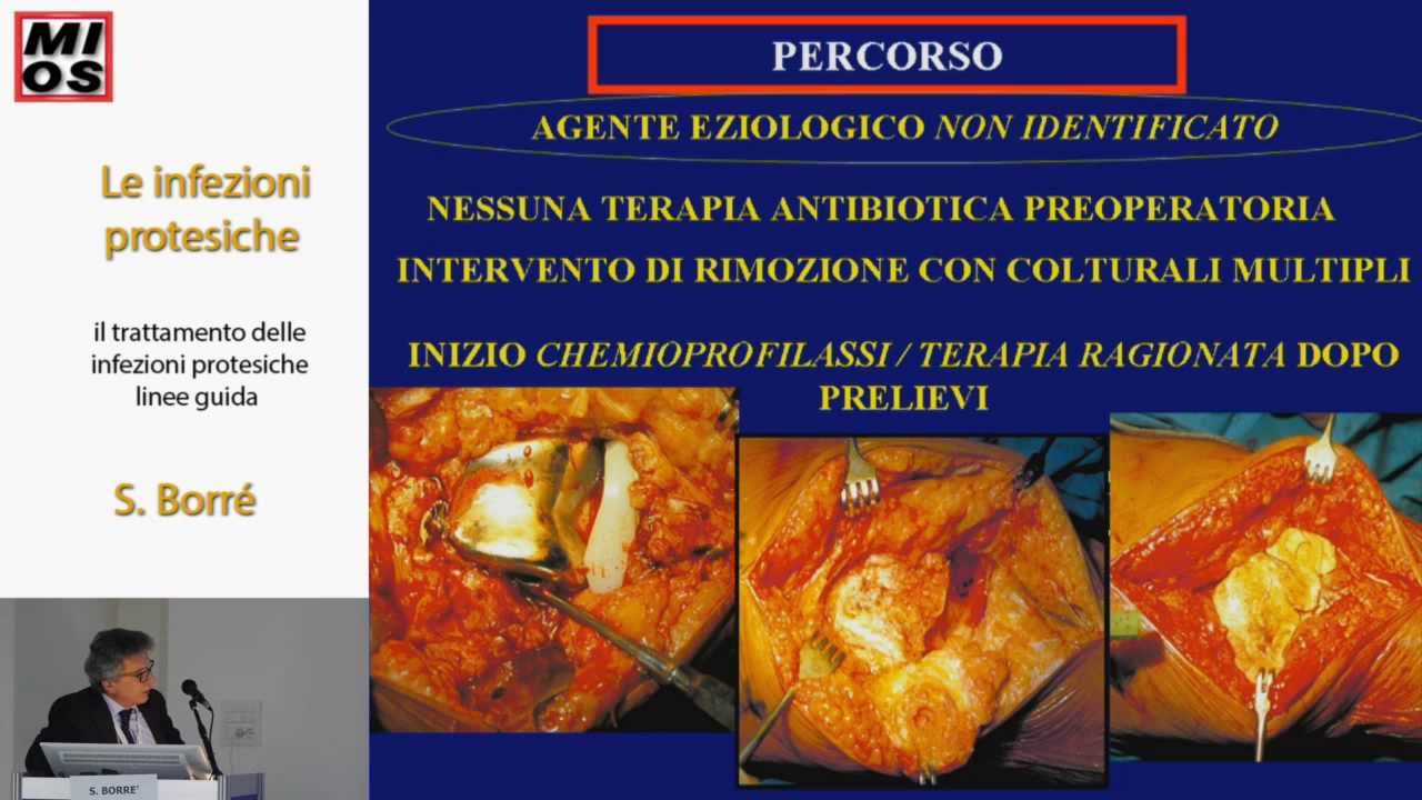 1 - Il trattamento delle infezioni protesiche - Linee guida - S.Borrè
