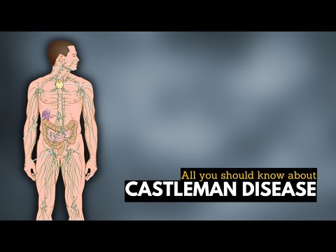 Lymphedema Causes Signs and Symptoms Diagnosis and Treatment