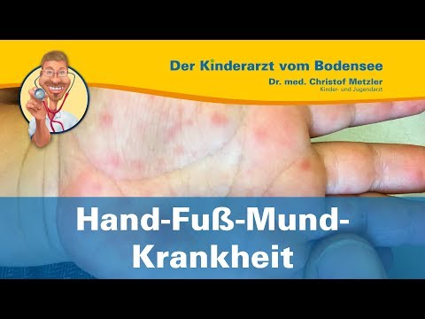 Das knötchenförmige Ekzem des Fotos Atopitscheski und die Kontakthautentzündung des Fotos