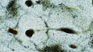 Histología del cartilago y hueso CAPÍTULO 5