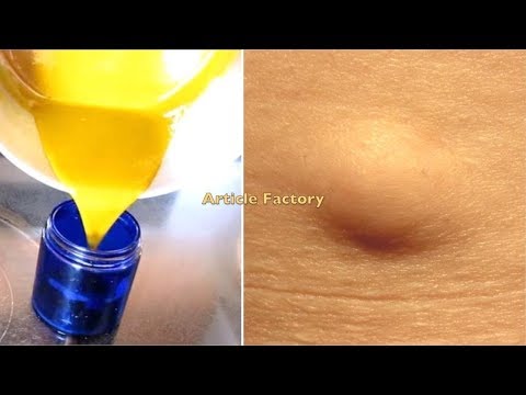 HOT NEWS!! How To Get Rid Of Skin Lumps Lipomas Naturally - Healthy Club