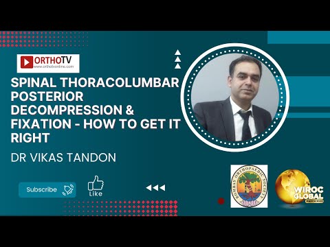 Spinal Thoracolumbar Posterior Decompression & Fixation - How to get it right - Dr Vikas Tandon