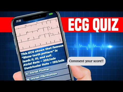 ECG quiz by Daily Cardiology | Become an ECG Master 