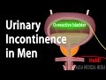 Urinary Incontinence In Men Animation