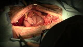 Gastrostomy tube placement in dogs