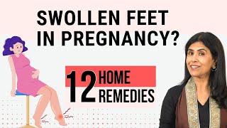 12 Home Remedies for Swollen feet in Pregnancy | Dr. Anjali Kumar | Maitri