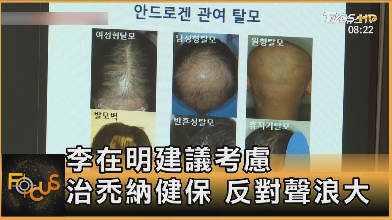 2、30歲掉髮患者近4成 南韓掀抗禿潮 李在明喊納健保引戰