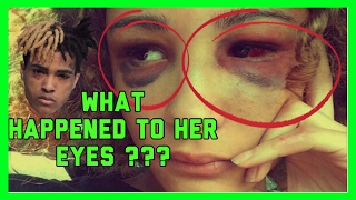 WHAT HAPPENED TO HER EYES ?? ( BASICALLY WHY XXXTENTACION IS LOCKED UP)