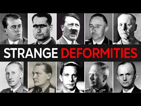 25 Nazis With SECRET Disabilities and Deformities You Never Learned About