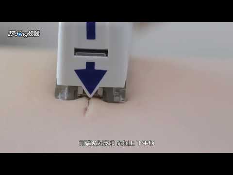 Disposable Skin Stapler And Remover - REAL