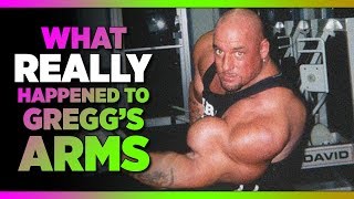What Do Gregg’s Arms Look Like Now? | Storytime With Gregg Valentino