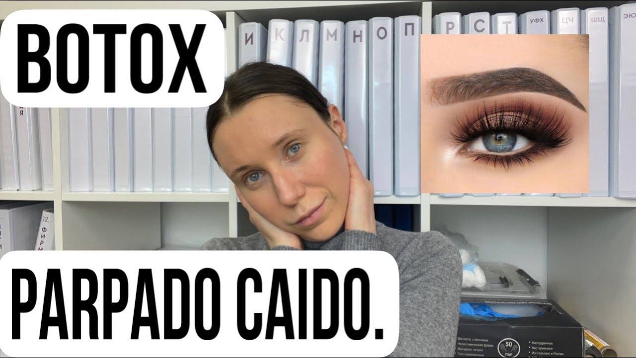 EL PARPADO CAIDO DESPUES BOTOX. El tratamiento rapido.