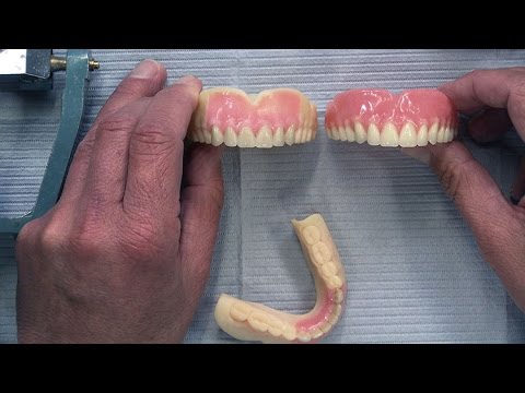 Case of the week: Highlighting the CAD/CAM Denture Process Video