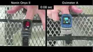 Product video: Nonin Onyx Vantage 9590 Finger Pulse Oximeter