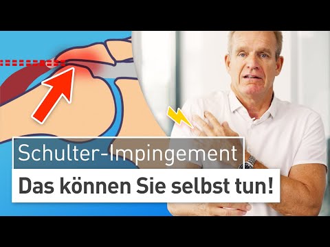 Treat impingement syndrome without surgery: Get rid of shoulder pain!