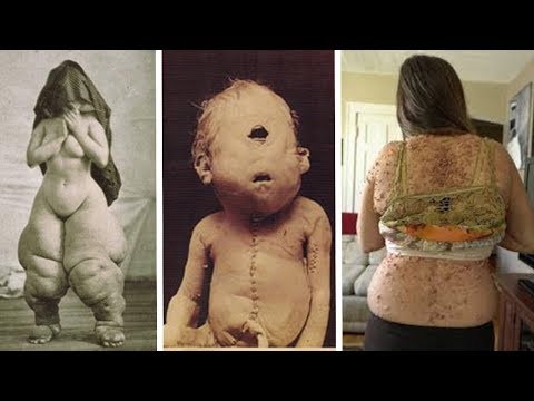 5 Disturbing Medical Images from History - 10 disturbing medical images from history  / жесть