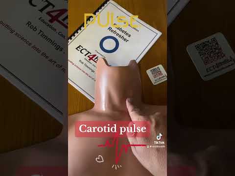Carotid pulse