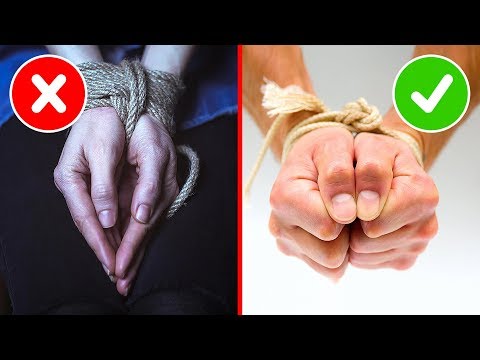 Talco nelle articolazioni Dito contuso pigna congiunta