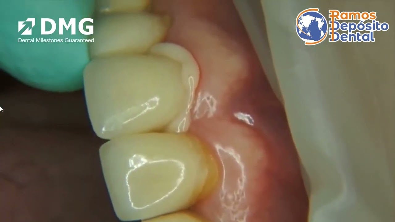 Permacem 2 0  Trim!!