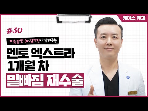 수술 4년 후 밑빠짐, 재수술 후 모양 변화 궁금하다면 | 윈느성형외과 라벨윈느 유튜브 영상