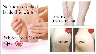 How To Get Rid Of Dry & Cracked Heels | LIVE Magical Result in just 4 hours | At Home Quick Pedicure