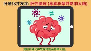 Cirrhosis-Patient & Public Education - Chinese/Mandarin