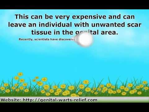 Genital Warts Treatment And HPV Symptoms - How To Get Fast Effect Relief Through Nature