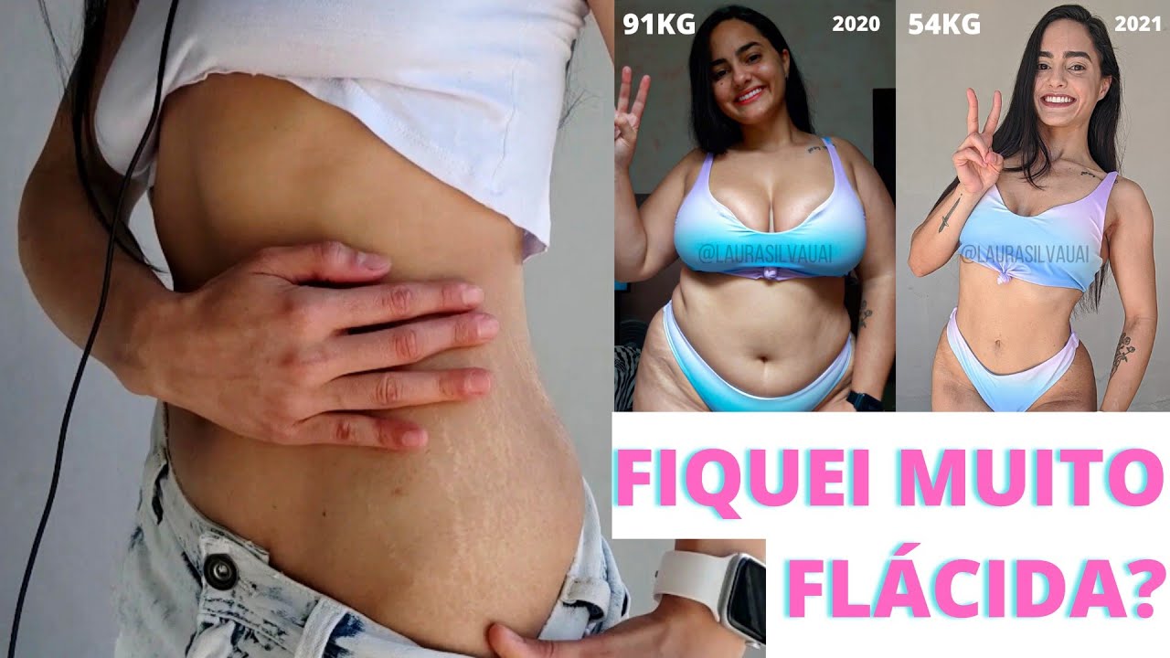 TOUR PELO MEU CORPO APÓS ELIMINAR 37KG | mostrei tudo+dicas para flacidez