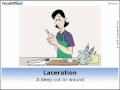 Vocabahead-laceration