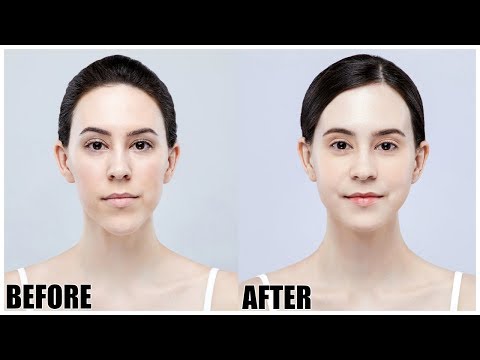 I Got Plastic Surgery in Korea || Before & After || Double Jaw Surgery Experience Part 2 Video