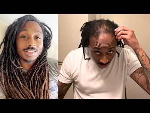 Video thumbnail for “SHAVING ALL My BALDING LOCKS — Extreme Transformation” on Baldcafe / YouTube